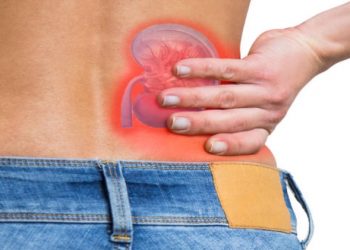 Best Medical Treatment for Kidney Stones