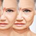 Most-Innovative-Anti-ageing-Treatments-to-Try1