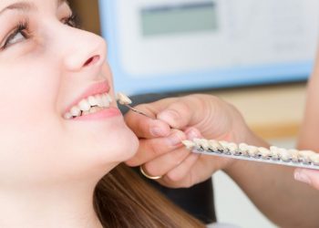 Procedure for the placement of dental veneers