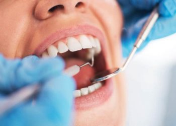 5 most common dental diseases