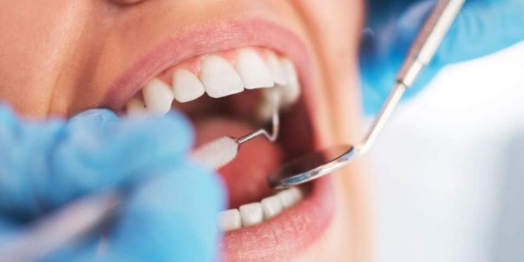 5 most common dental diseases