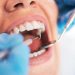 5 most common dental diseases