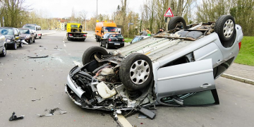 motor vehicle accidents therapy in Calgary