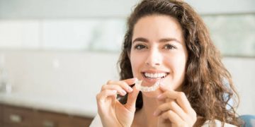 How To Get the Best Price on Invisalign?