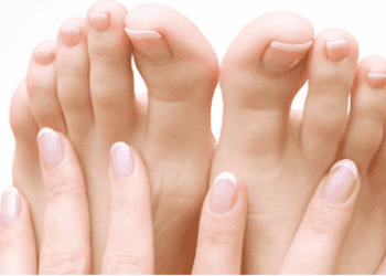 How to Get Rid of Thick White Stuff Under the Toenail?