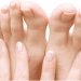 How to Get Rid of Thick White Stuff Under the Toenail?