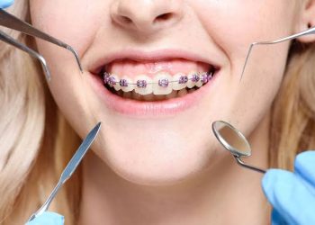 Why Dentist Checkup On Regular Basis Is Important!