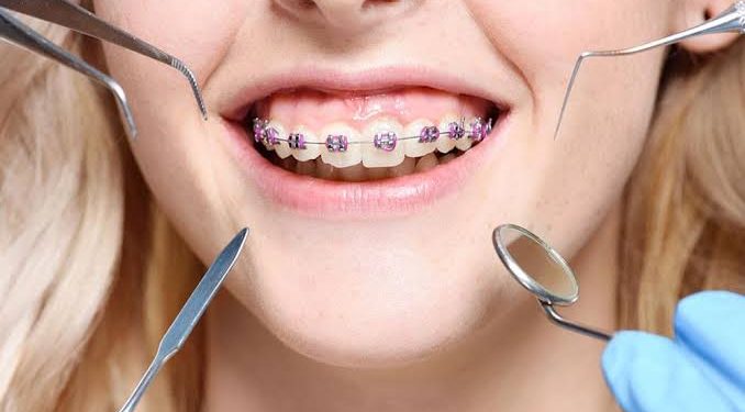 Why Dentist Checkup On Regular Basis Is Important!