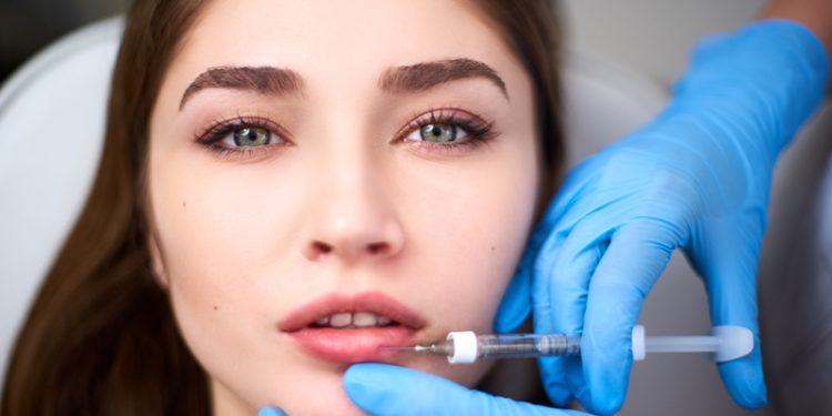 10 Things you must know about the Lip fillers