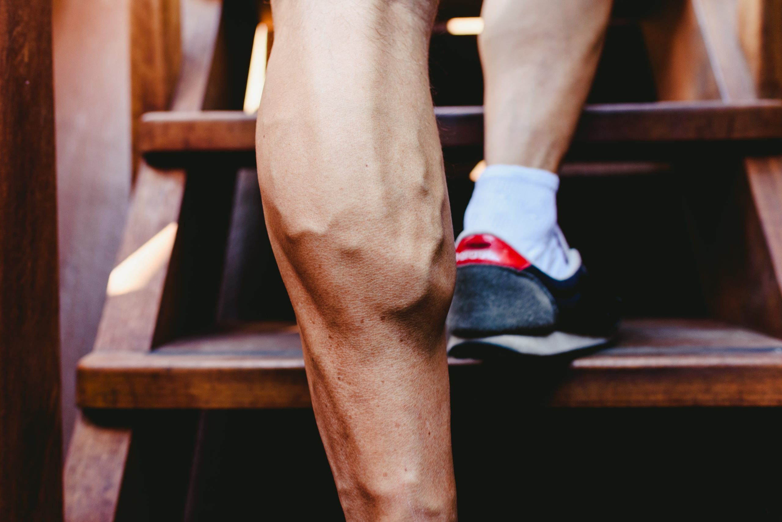 Veins Showing Through Your Skin? 5 Things You Should Know
