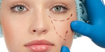 Boost Your Confidence with These 4 Inexpensive Cosmetic Procedures