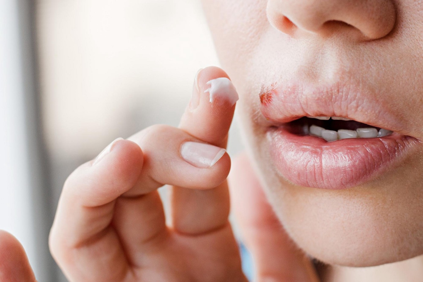 Possible Treatments