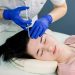 Other Medical Treatments That Can Affect A Hair Transplant