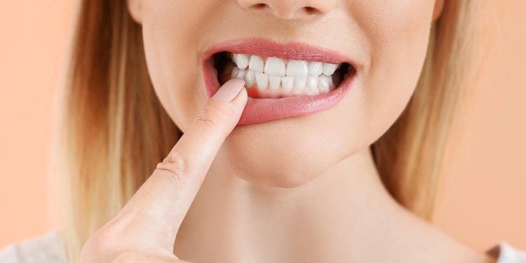 5 Ways to Prevent Periodontal Disease