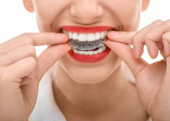 The Complete Guide on How Invisalign Works