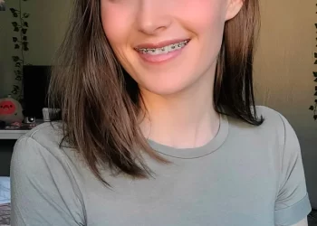 Top 5 Reasons to Fix Braces