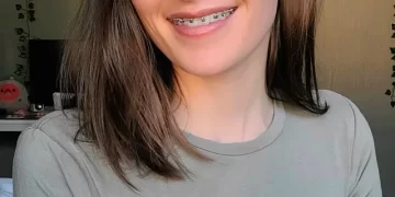 Top 5 Reasons to Fix Braces