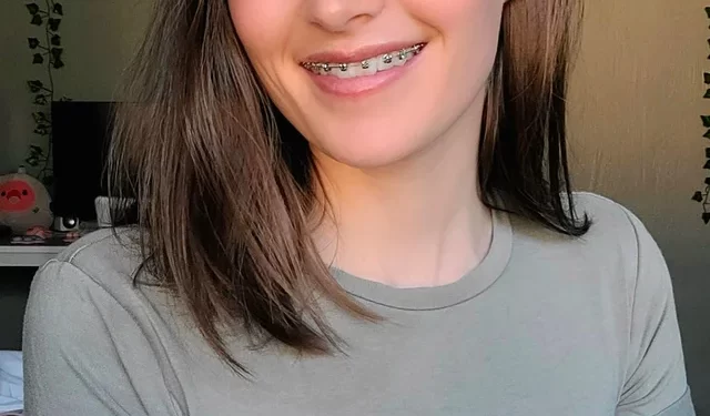 Top 5 Reasons to Fix Braces