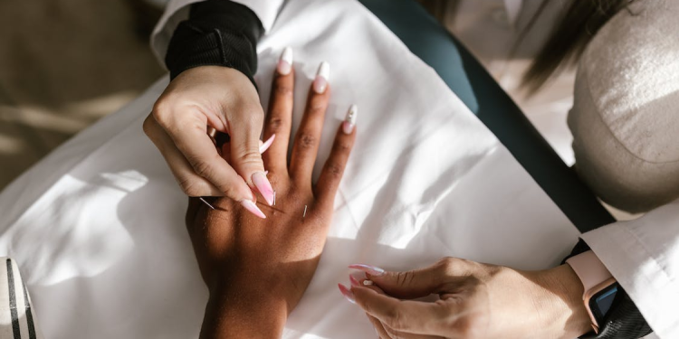 10 Benefits of Acupuncture