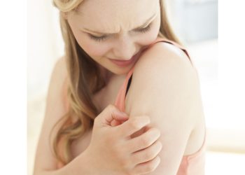 How to Deal with Psoriasis and Eczema Flare-ups in Winter