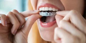 Top 7 Obvious Reasons The Invisalign Treatment Isn’t Working For You!