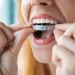 Top 7 Obvious Reasons The Invisalign Treatment Isn’t Working For You!