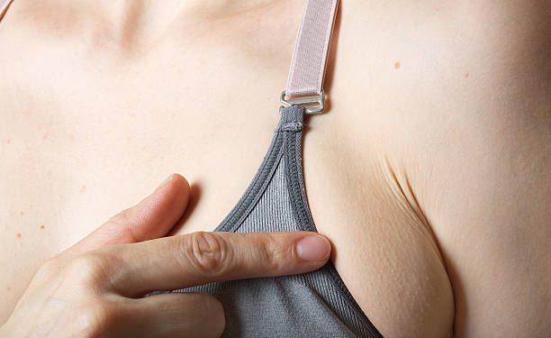 How to Get Rid of Armpit Fat