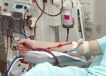 dialysis process