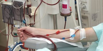 dialysis process