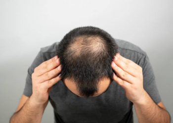 Health Care Focus: Female to Male Hair Transplants