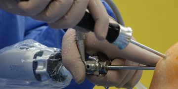 What Not To Eat After Endoscopy