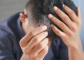 Minoxidil Purge Shedding: Signs, Timeline, and When to Worry