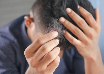 Minoxidil Purge Shedding: Signs, Timeline, and When to Worry
