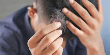 Minoxidil Purge Shedding: Signs, Timeline, and When to Worry