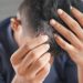 Minoxidil Purge Shedding: Signs, Timeline, and When to Worry